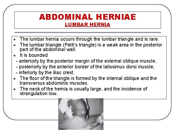 ABDOMINAL HERNIAE LUMBAR HERNIA The lumbar hernia occurs through the lumbar triangle and is