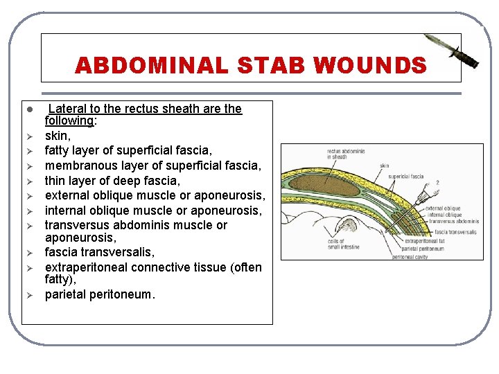 ABDOMINAL STAB WOUNDS l Ø Ø Ø Ø Ø Lateral to the rectus sheath