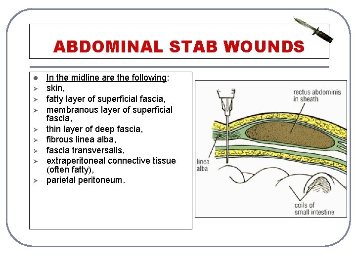 ABDOMINAL STAB WOUNDS l Ø Ø Ø Ø In the midline are the following:
