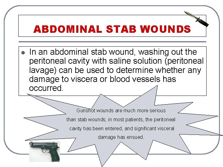 ABDOMINAL STAB WOUNDS l In an abdominal stab wound, washing out the peritoneal cavity