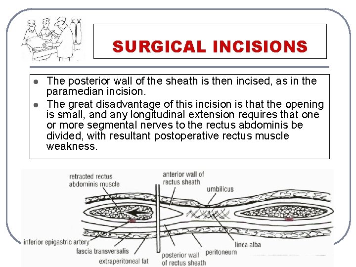 SURGICAL INCISIONS l l The posterior wall of the sheath is then incised, as