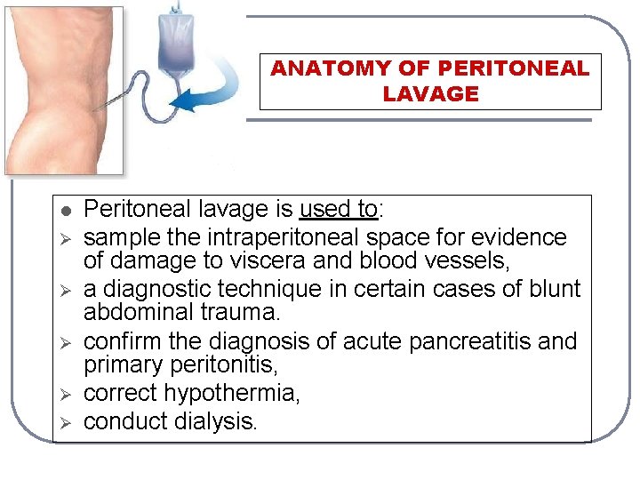 ANATOMY OF PERITONEAL LAVAGE l Ø Ø Ø Peritoneal lavage is used to: sample