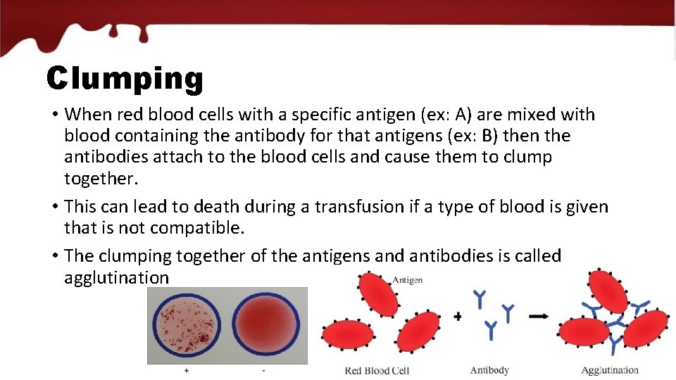 Clumping • When red blood cells with a specific antigen (ex: A) are mixed