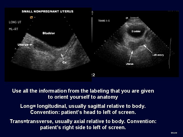 Use all the information from the labeling that you are given to orient yourself