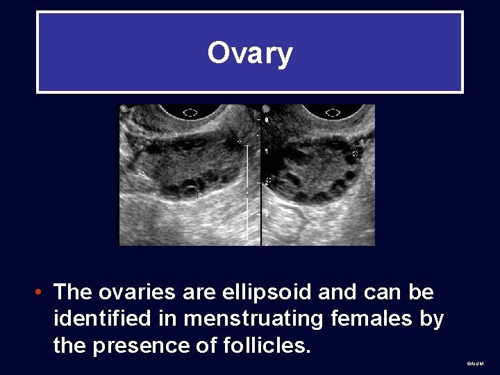 Ovary • The ovaries are ellipsoid and can be identified in menstruating females by