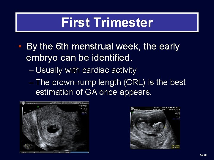 First Trimester • By the 6 th menstrual week, the early embryo can be