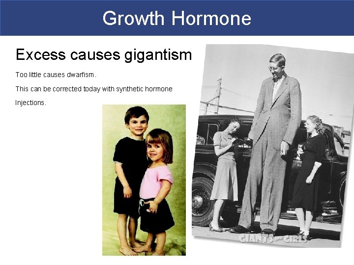 Growth Hormone Excess causes gigantism Too little causes dwarfism. This can be corrected today