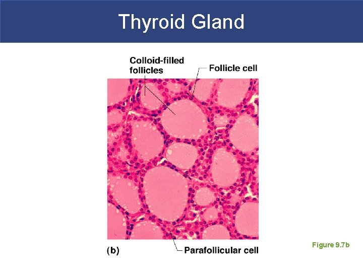 Thyroid Gland Figure 9. 7 b 