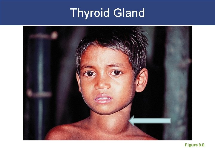 Thyroid Gland Figure 9. 8 