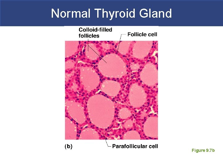 Normal Thyroid Gland Figure 9. 7 b 