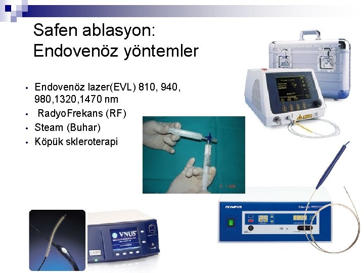 Safen ablasyon: Endovenöz yöntemler • • Endovenöz lazer(EVL) 810, 940, 980, 1320, 1470 nm