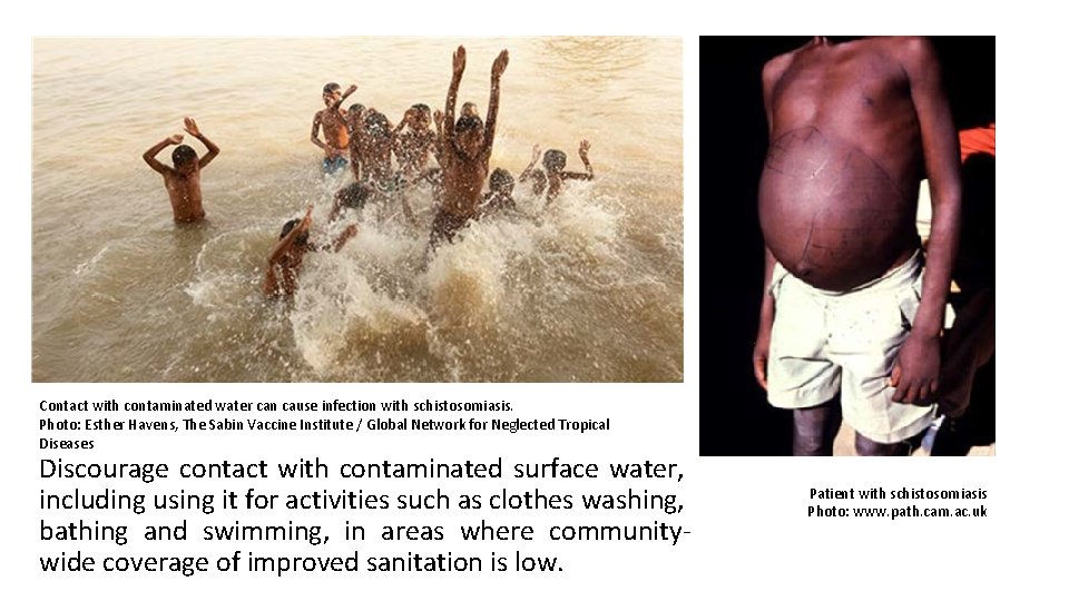 Contact with contaminated water can cause infection with schistosomiasis. Photo: Esther Havens, The Sabin