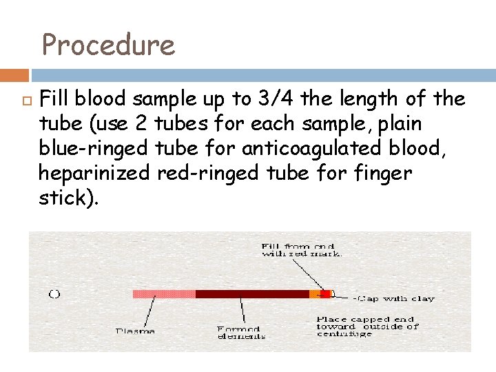 Procedure Fill blood sample up to 3/4 the length of the tube (use 2