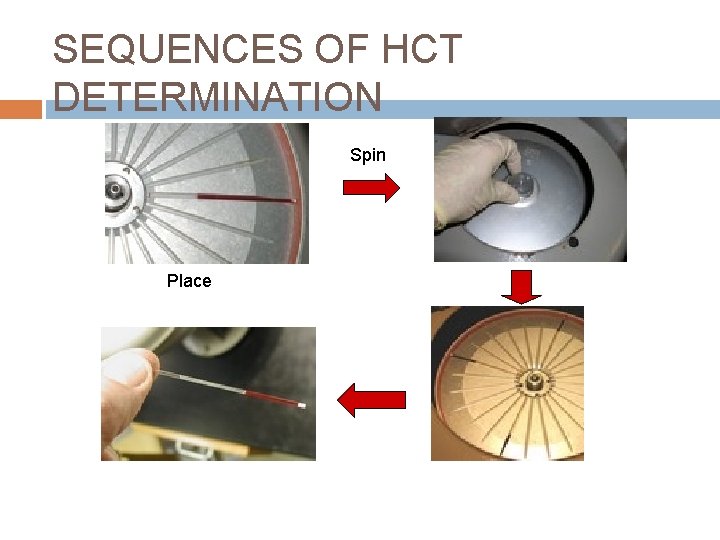 SEQUENCES OF HCT DETERMINATION Spin Place 