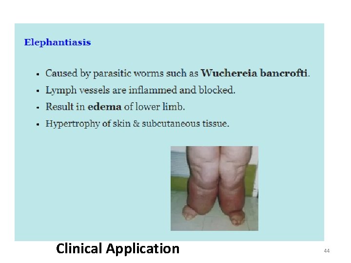 Clinical Application 44 