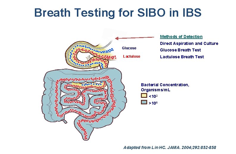 Breath Testing for SIBO in IBS Methods of Detection Direct Aspiration and Culture Glucose
