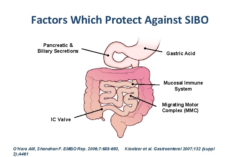 Factors Which Protect Against SIBO Pancreatic & Biliary Secretions Gastric Acid Mucosal Immune System