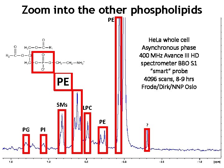 Zoom into the other phospholipids PE He. La whole cell Asynchronous phase 400 MHz