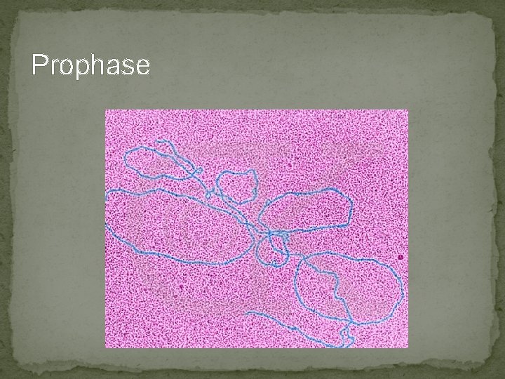 Prophase Prophase