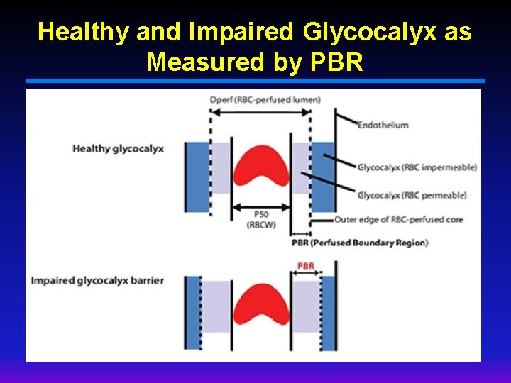 Healthy and Impaired Glycocalyx as Measured by PBR 