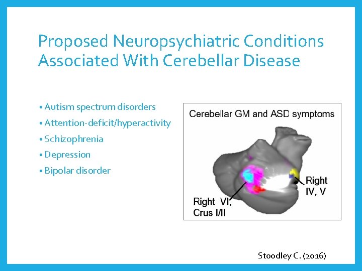 Proposed Neuropsychiatric Conditions Associated With Cerebellar Disease • Autism spectrum disorders • Attention-deficit/hyperactivity •