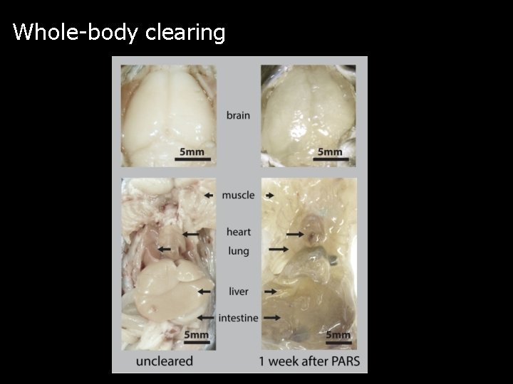 Whole-body clearing 