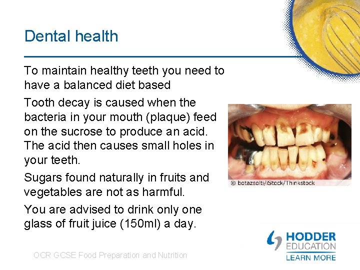 Dental health To maintain healthy teeth you need to have a balanced diet based