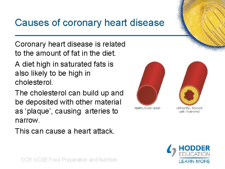 Causes of coronary heart disease Coronary heart disease is related to the amount of