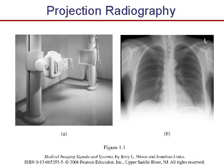 Projection Radiography 