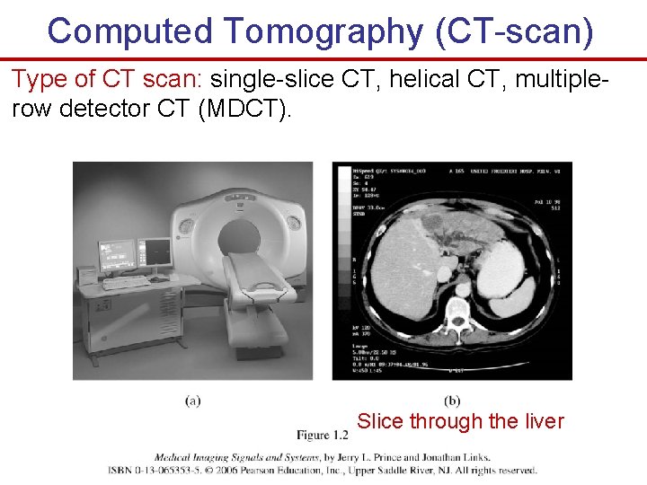 Computed Tomography (CT-scan) Type of CT scan: single-slice CT, helical CT, multiplerow detector CT