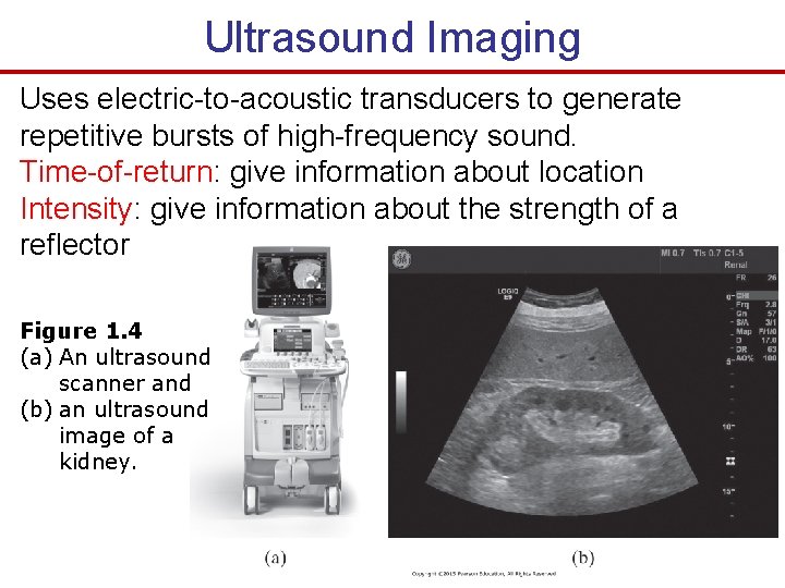 Ultrasound Imaging Uses electric-to-acoustic transducers to generate repetitive bursts of high-frequency sound. Time-of-return: give