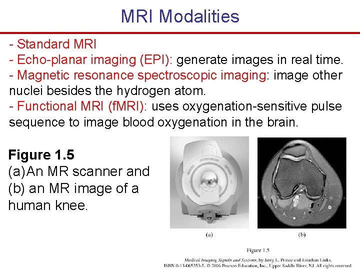 MRI Modalities - Standard MRI - Echo-planar imaging (EPI): generate images in real time.