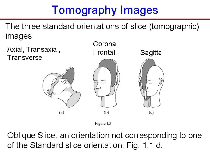 Tomography Images The three standard orientations of slice (tomographic) images Axial, Transaxial, Transverse Coronal
