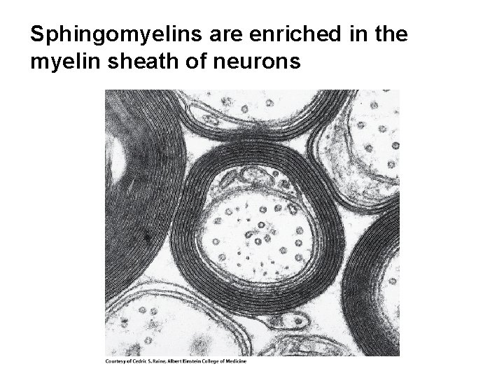 Sphingomyelins are enriched in the myelin sheath of neurons 