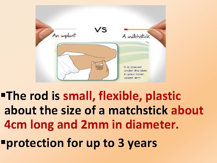 §The rod is small, flexible, plastic about the size of a matchstick about 4