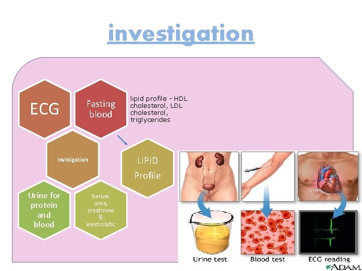 investigation ECG Fasting blood invistigation lipid profile - HDL cholesterol, LDL cholesterol, triglycerides LIPID