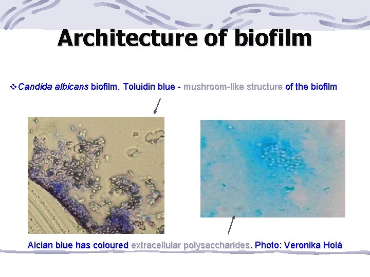 Architecture of biofilm v. Candida albicans biofilm. Toluidin blue - mushroom-like structure of the