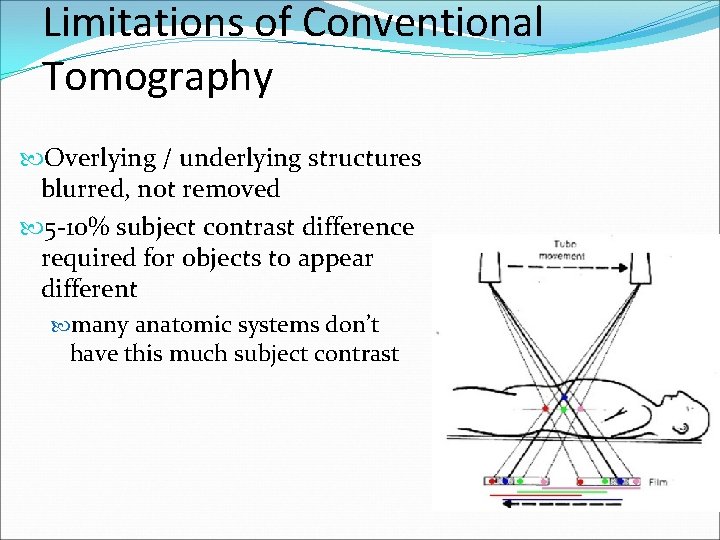 Limitations of Conventional Tomography Overlying / underlying structures blurred, not removed 5 -10% subject