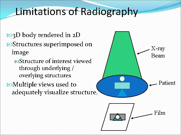 Limitations of Radiography 3 D body rendered in 2 D Structures superimposed on image