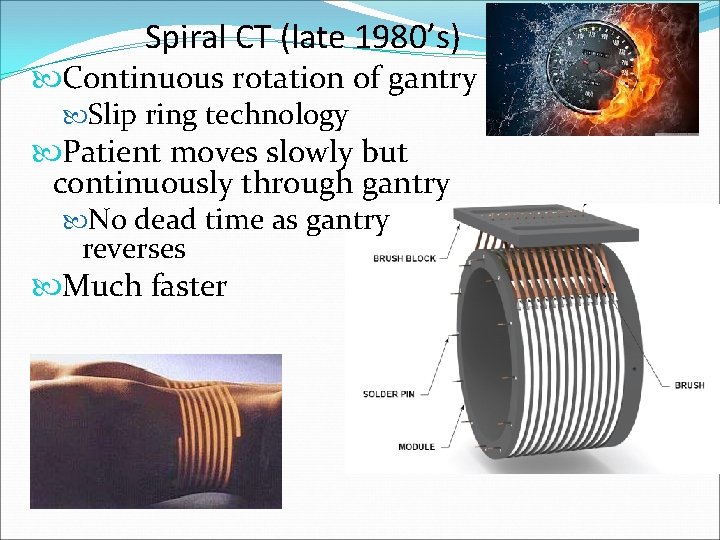 Spiral CT (late 1980’s) Continuous rotation of gantry Slip ring technology Patient moves slowly