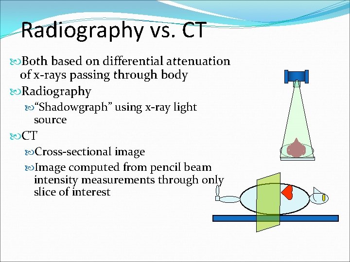 Radiography vs. CT Both based on differential attenuation of x-rays passing through body Radiography