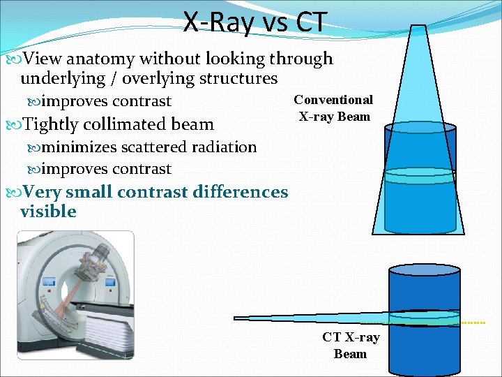 X-Ray vs CT View anatomy without looking through underlying / overlying structures Conventional improves