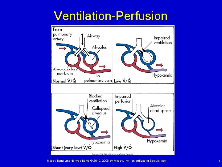 Ventilation-Perfusion Mosby items and derived items © 2010, 2006 by Mosby, Inc. , an