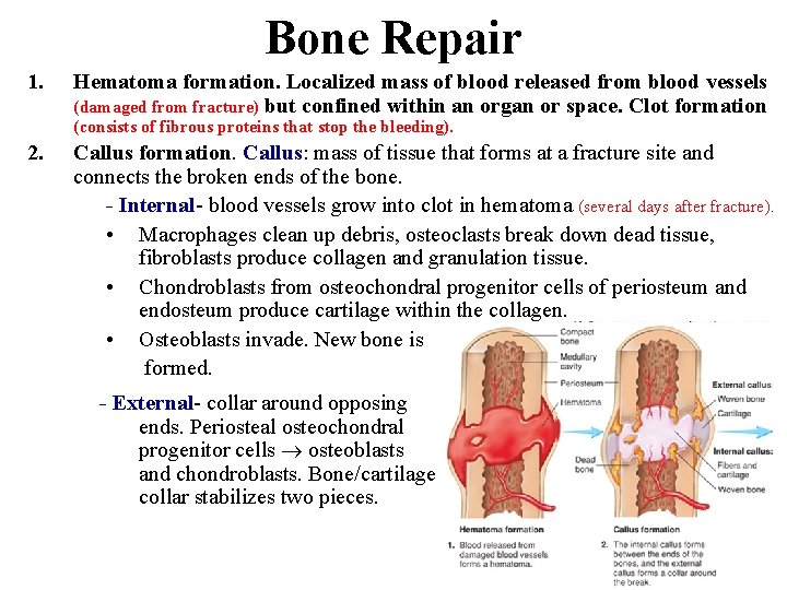 Bone Repair 1. Hematoma formation. Localized mass of blood released from blood vessels (damaged