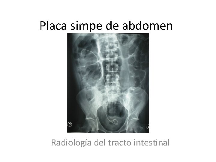 Placa simpe de abdomen Radiología del tracto intestinal 