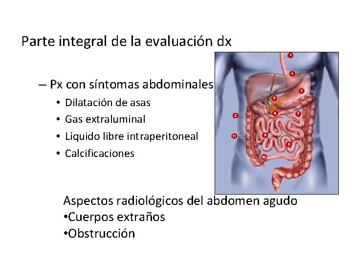 Parte integral de la evaluación dx – Px con síntomas abdominales • • Dilatación