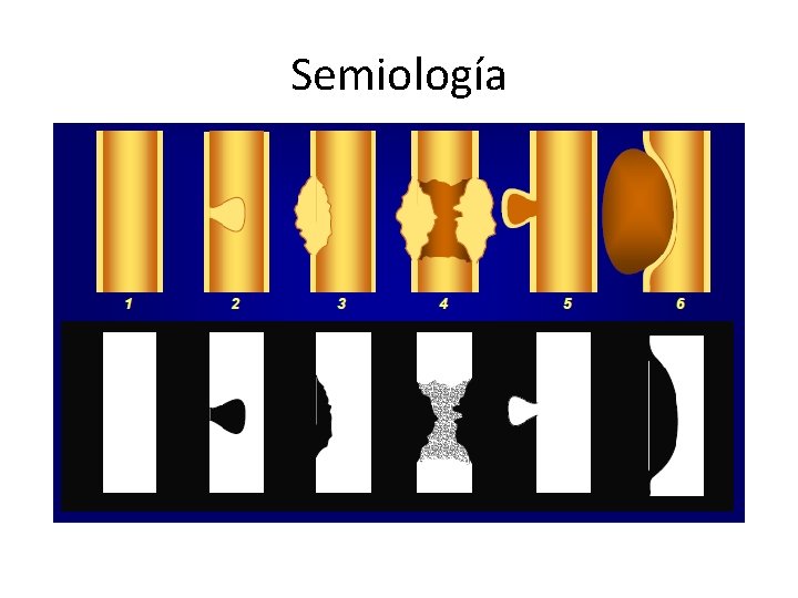 Semiología 