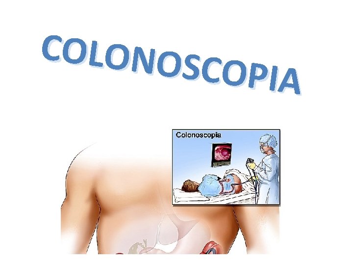 COLONOS COPIA 