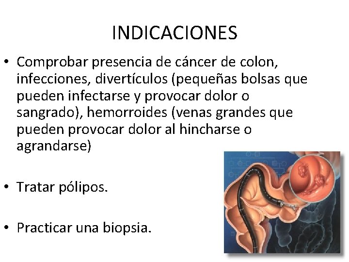 INDICACIONES • Comprobar presencia de cáncer de colon, infecciones, divertículos (pequeñas bolsas que pueden