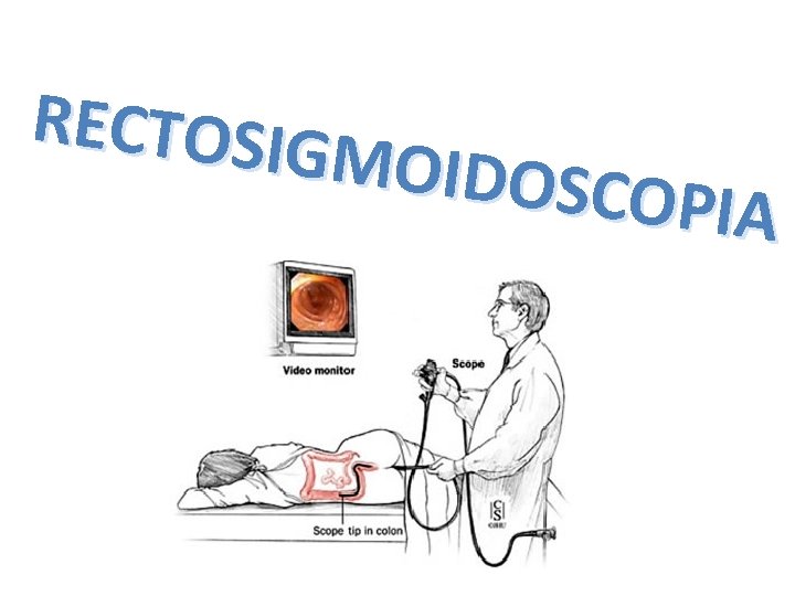 RECTOSIG MOIDOSC OPIA 